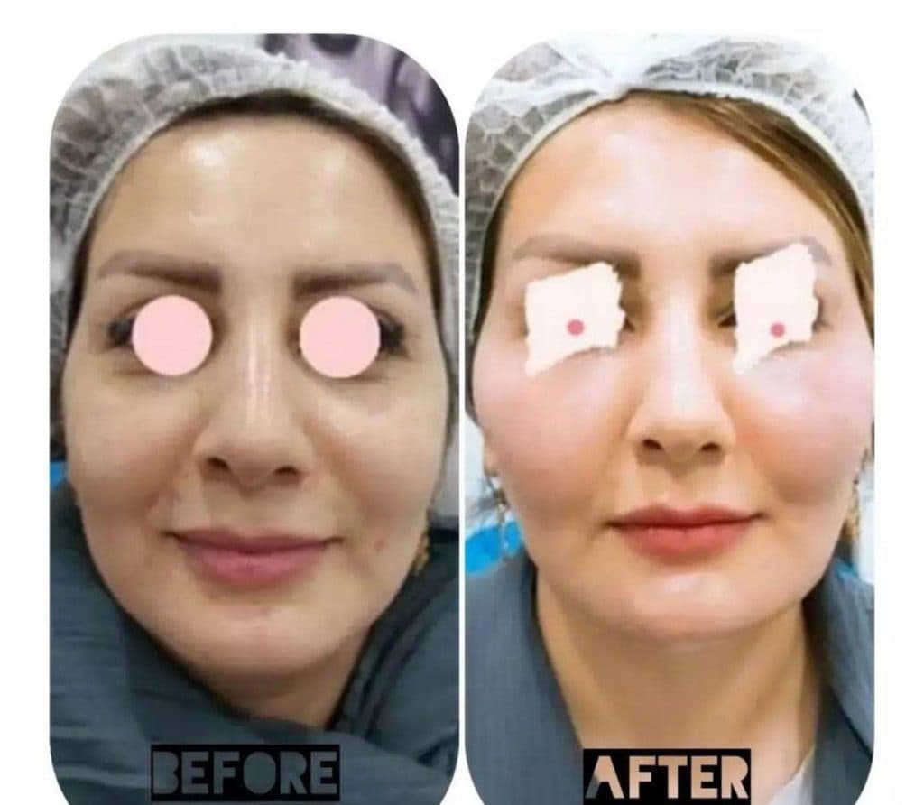 کلینیک لیزر و زیبایی رز سفید در چالوس