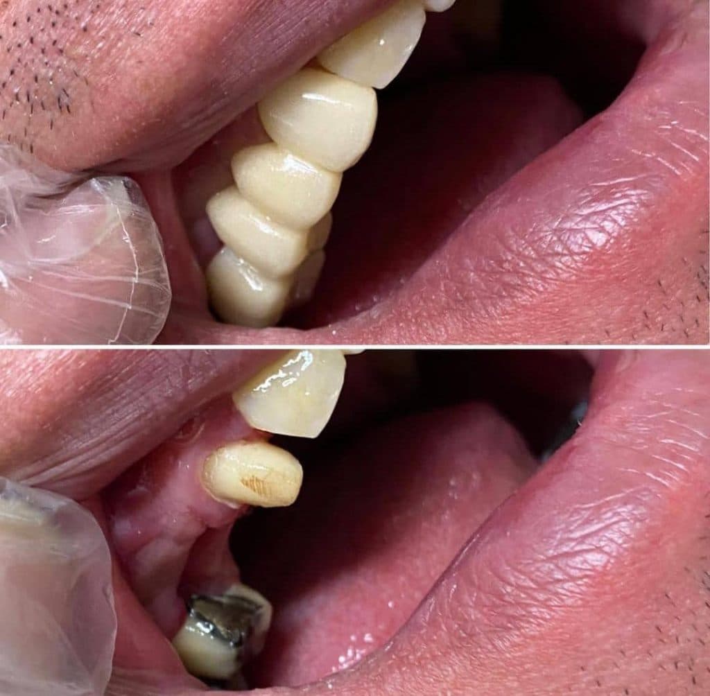 دندانسازی دیجیتال صدف در مازندران