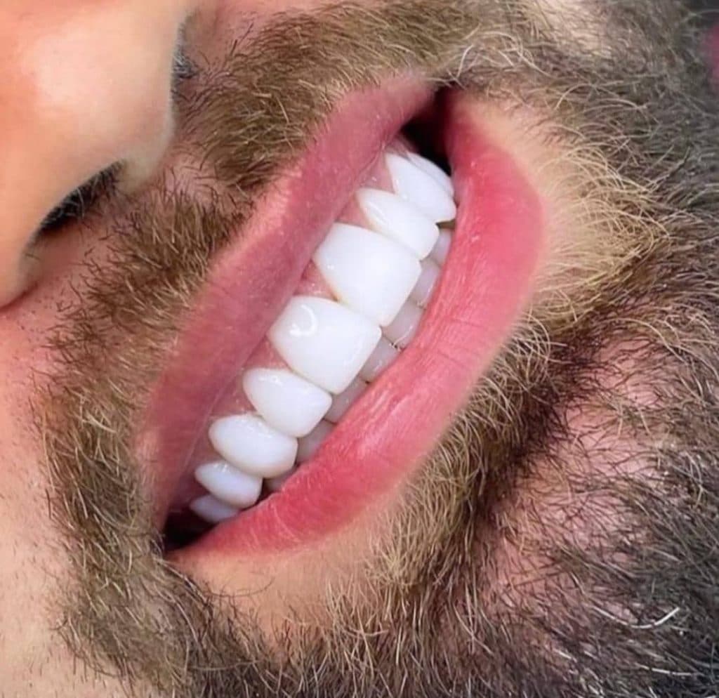 دندانسازی دیجیتال صدف در مازندران