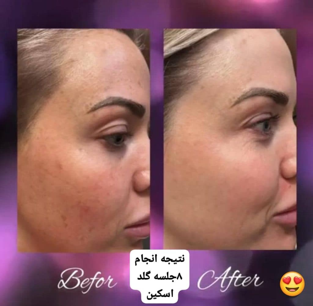 کلینیک زیبایی الی در تهران