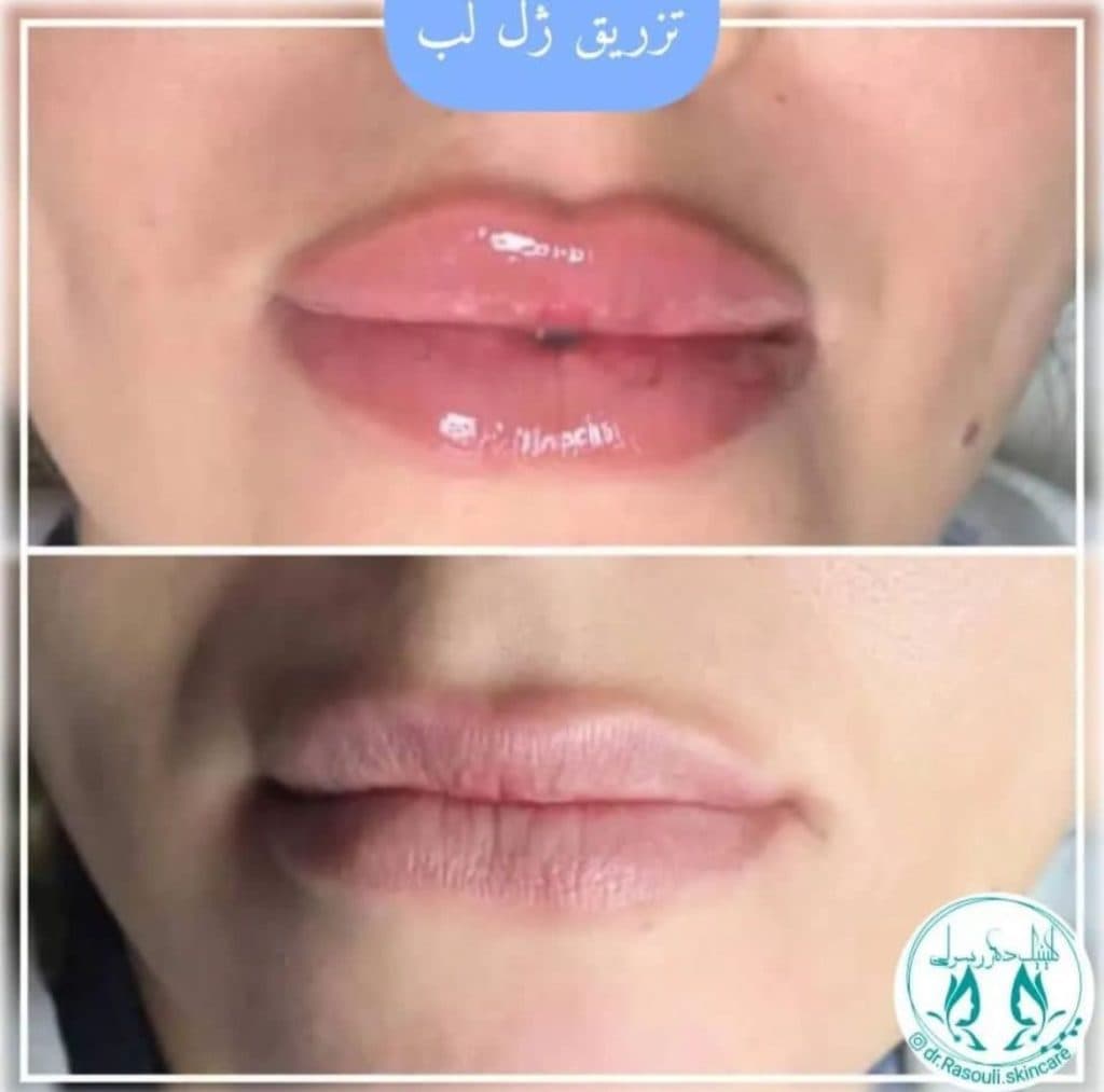 کلینیک زیبایی دکتر رسولی در آستانه اشرفیه
