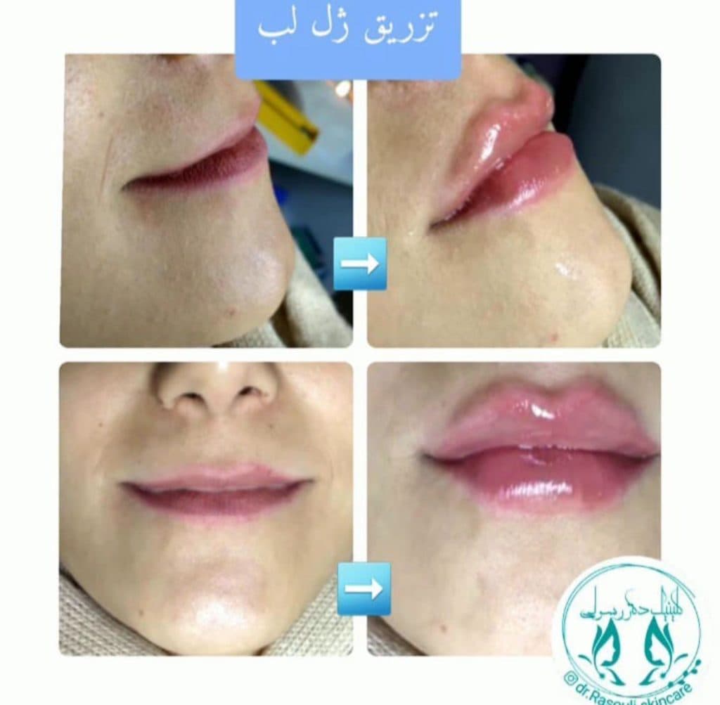 کلینیک زیبایی دکتر رسولی در آستانه اشرفیه