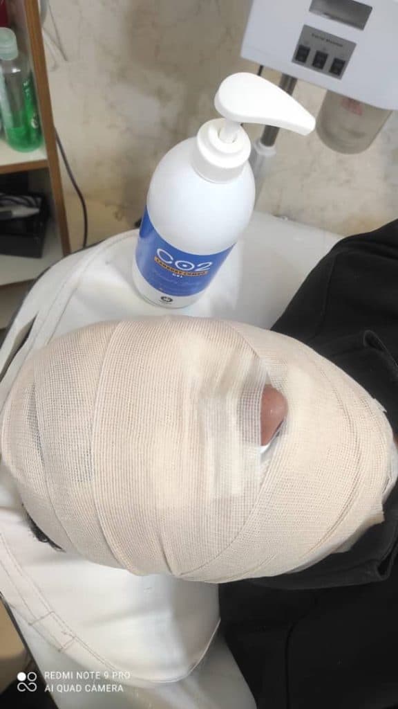 کلینیک تخصصی زیبایی پوست و مو الهام در قزوین