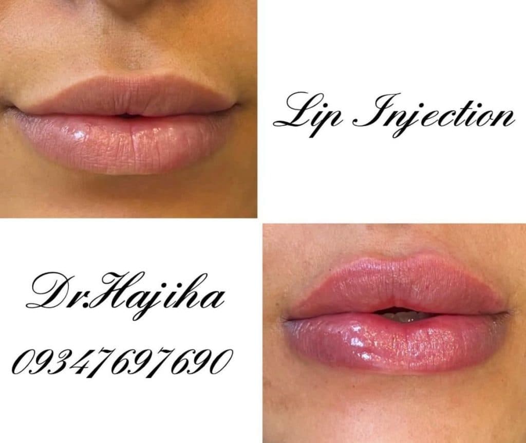 کلینیک زیبایی دکتر نیما حاجیها در جزیره کیش