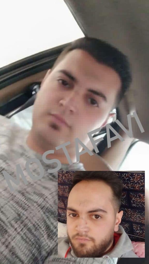 کلینیک تخصصی کاشت مو رویش در تبریز