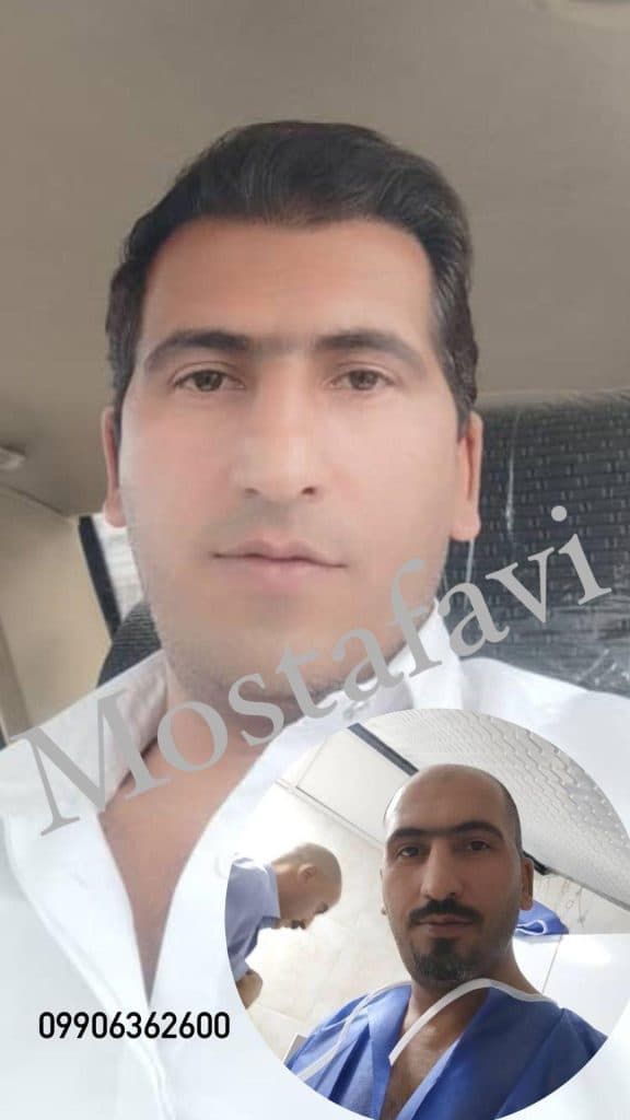 کلینیک تخصصی کاشت مو رویش در تبریز