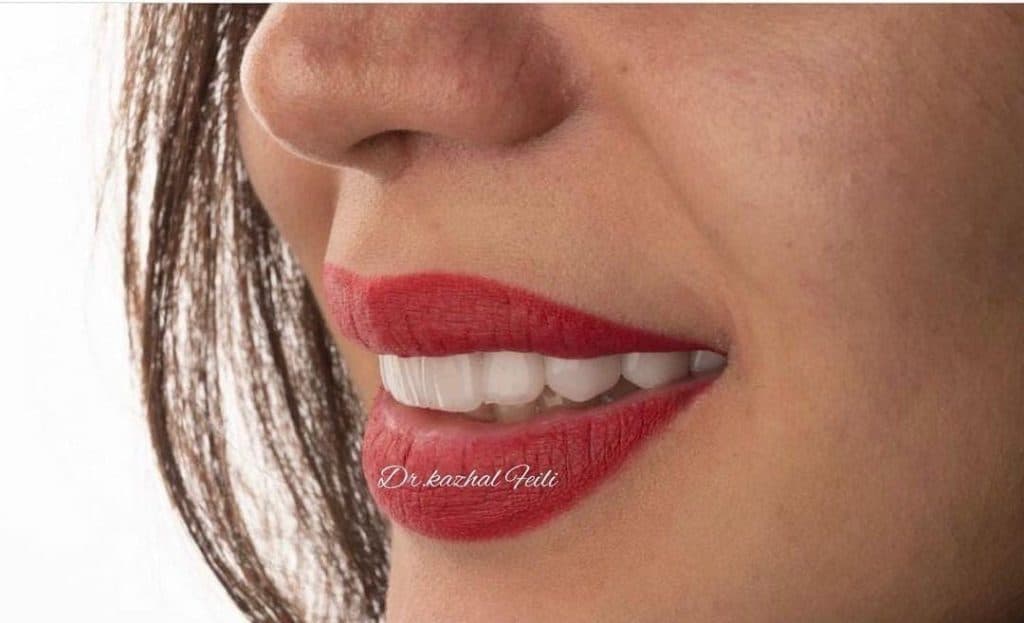 مطب دندانپزشکی دکتر کژال فیلی در سنندج کامیاران