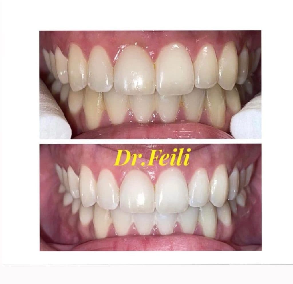 مطب دندانپزشکی دکتر کژال فیلی در سنندج کامیاران
