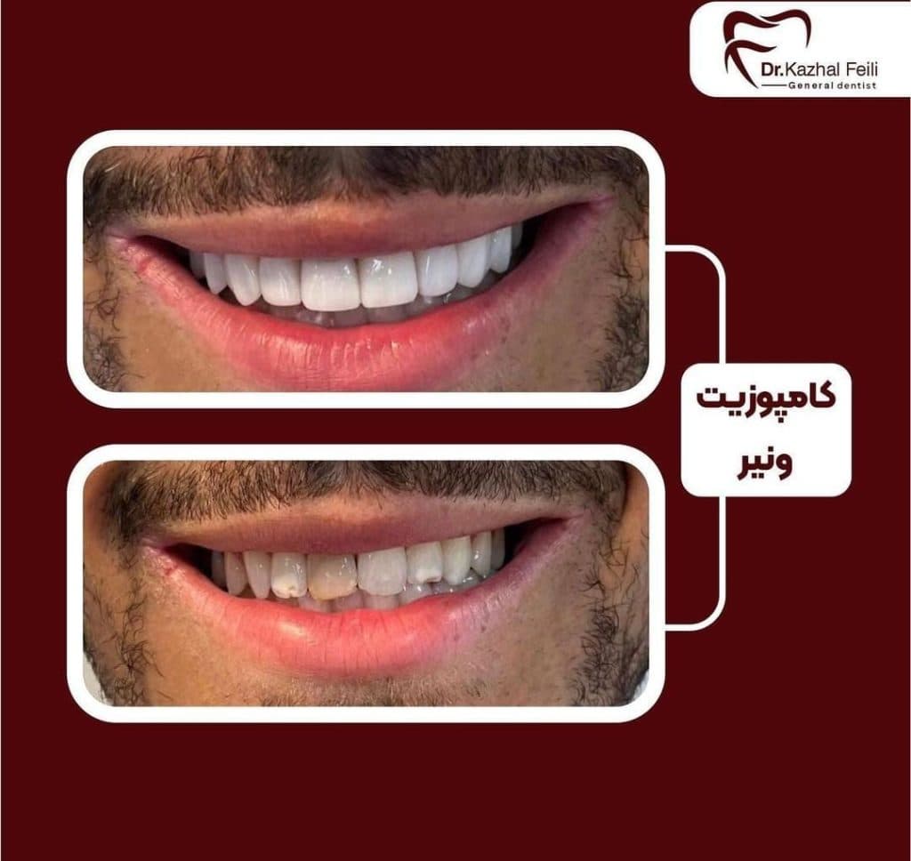 مطب دندانپزشکی دکتر کژال فیلی در سنندج کامیاران