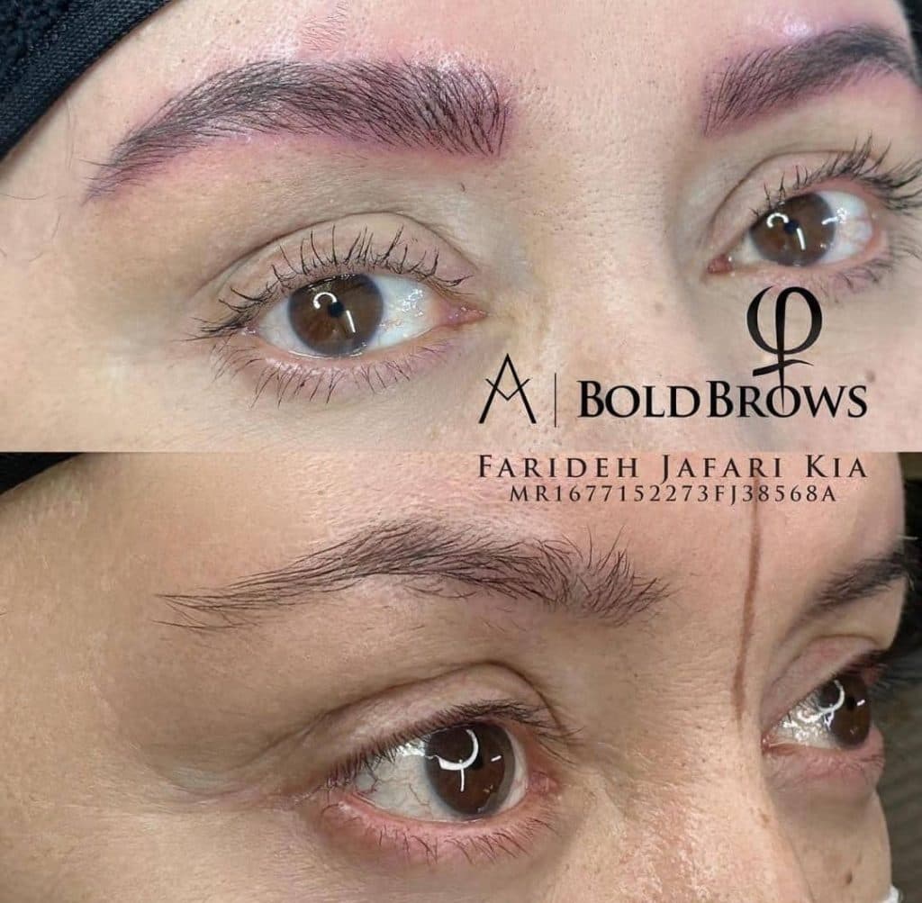 کلینیک زیبایی پوست مو و لیزر کیا آفرین در شیراز