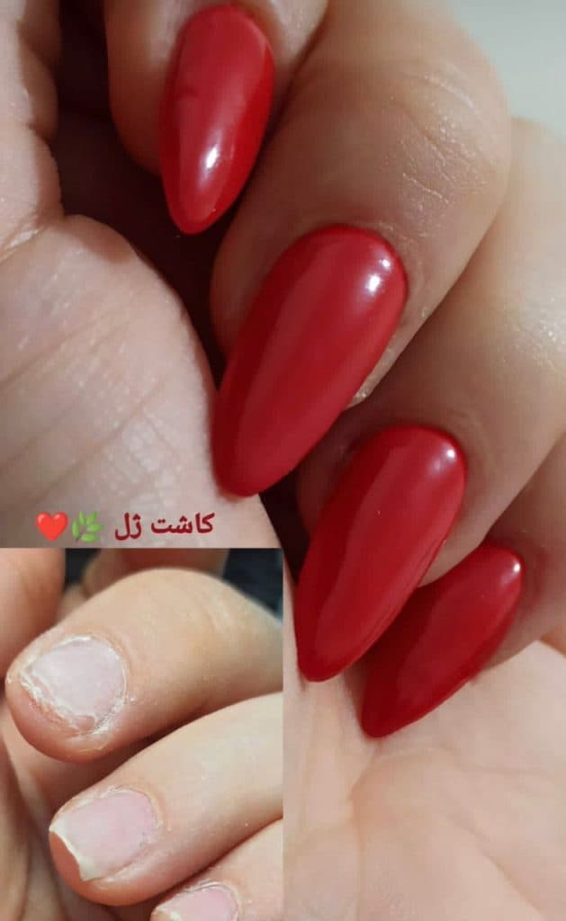 آموزش و خدمات کاشت و دیزاین ناخن یزدانی در بابلسر