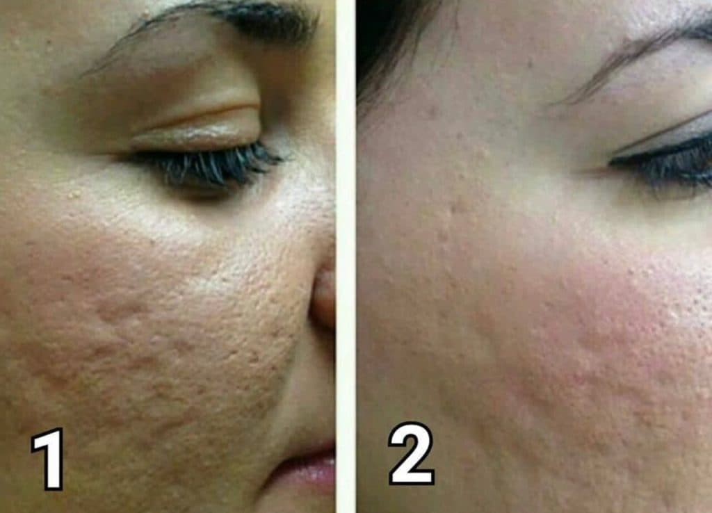 سالن زیبایی و فیشیال پوست آرامیس در سمنان