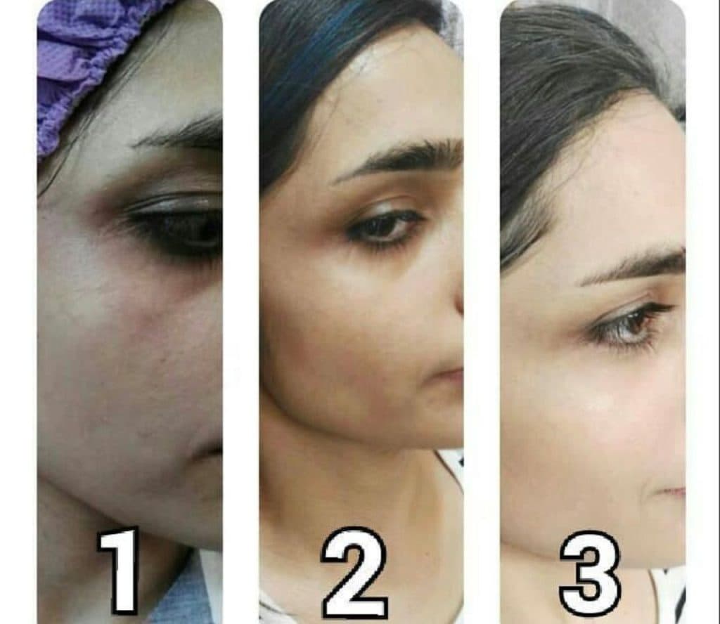 سالن زیبایی و فیشیال پوست آرامیس در سمنان