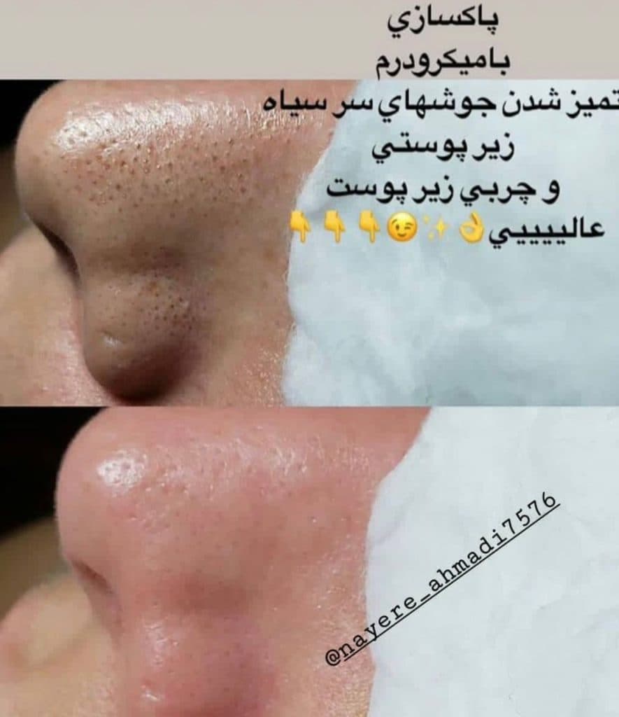 سالن زیبایی و فیشیال پوست آرامیس در سمنان