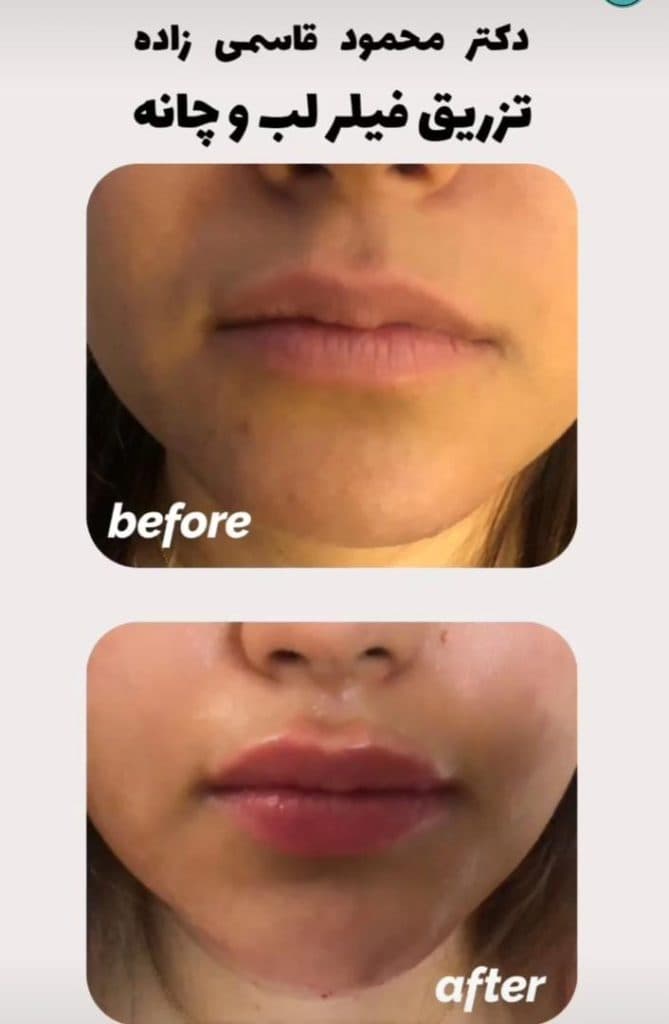 کلینیک زیبایی دکتر قاسمی زاده در بندرعباس