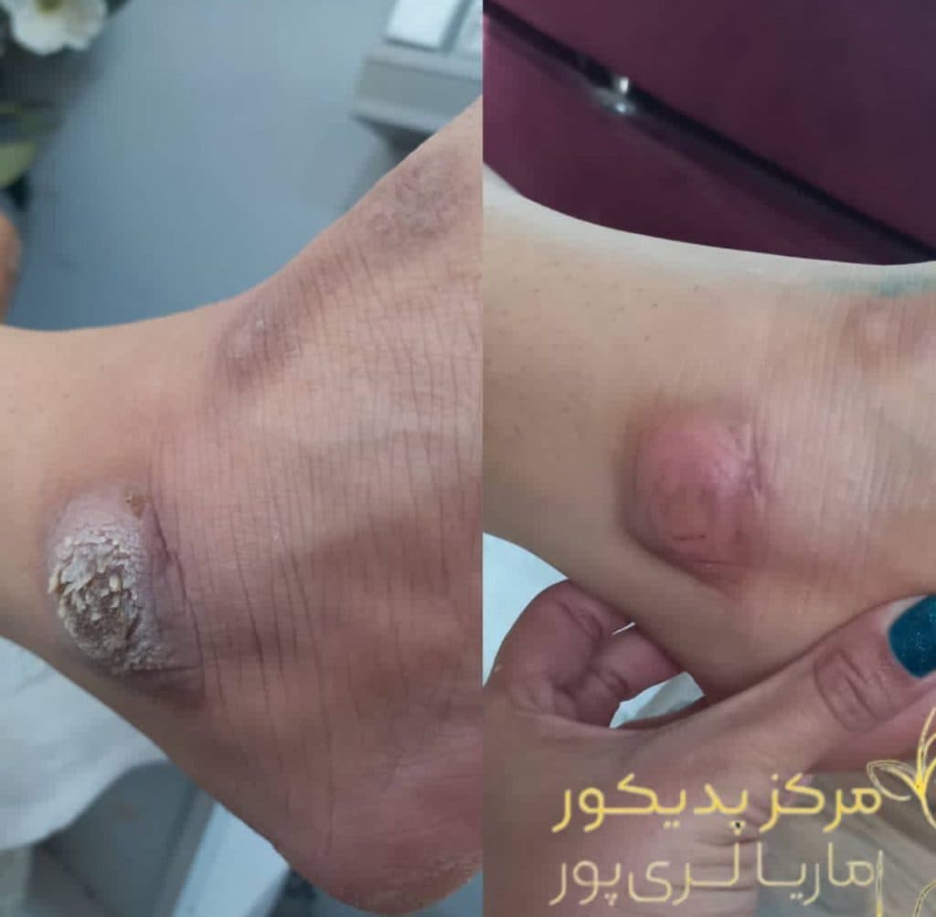 ماریا لری پور مدرس تخصصی پدیکور و پدولوژی در رفسنجان