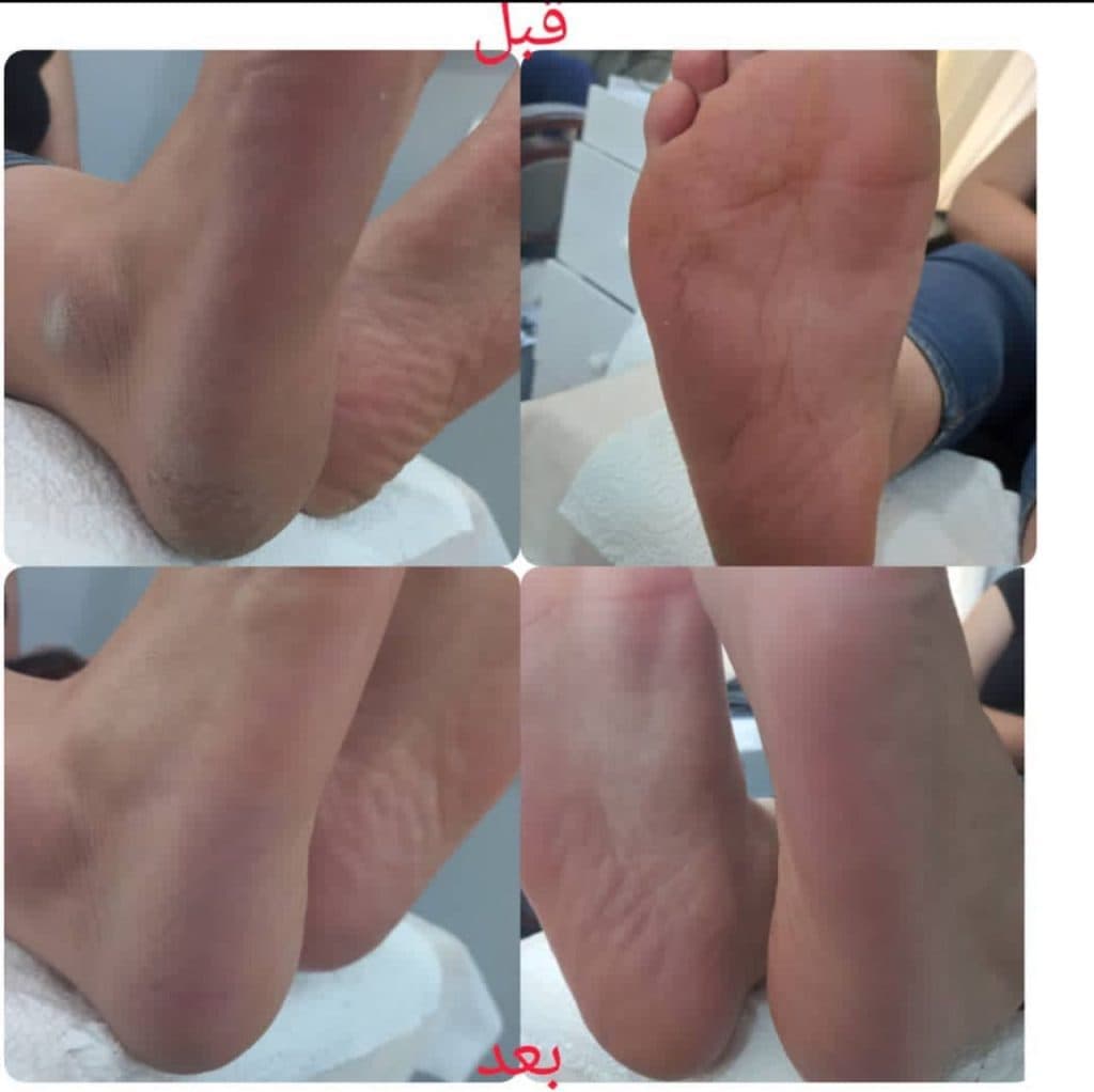 ماریا لری پور مدرس تخصصی پدیکور و پدولوژی در رفسنجان