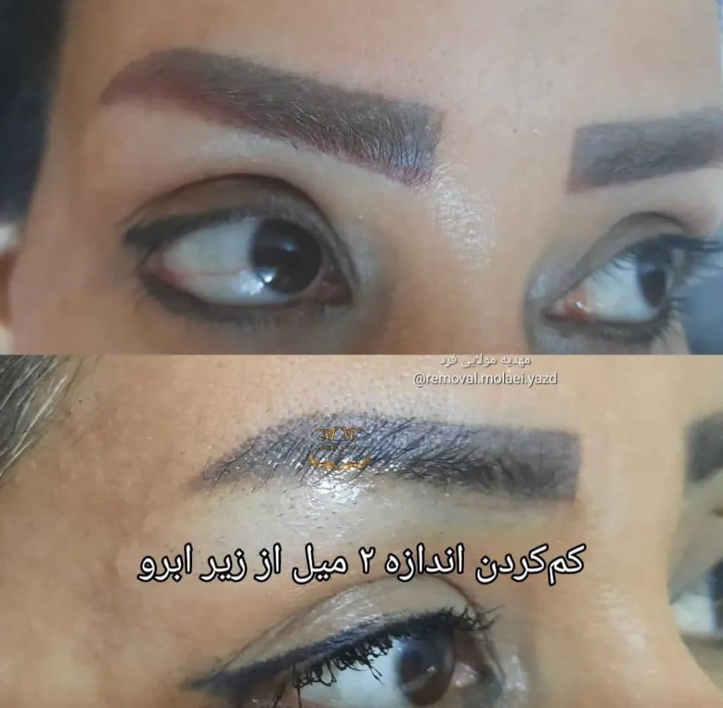 خدمات و آموزش تتو و ریمو مهدیه ملایی فرد در یزد