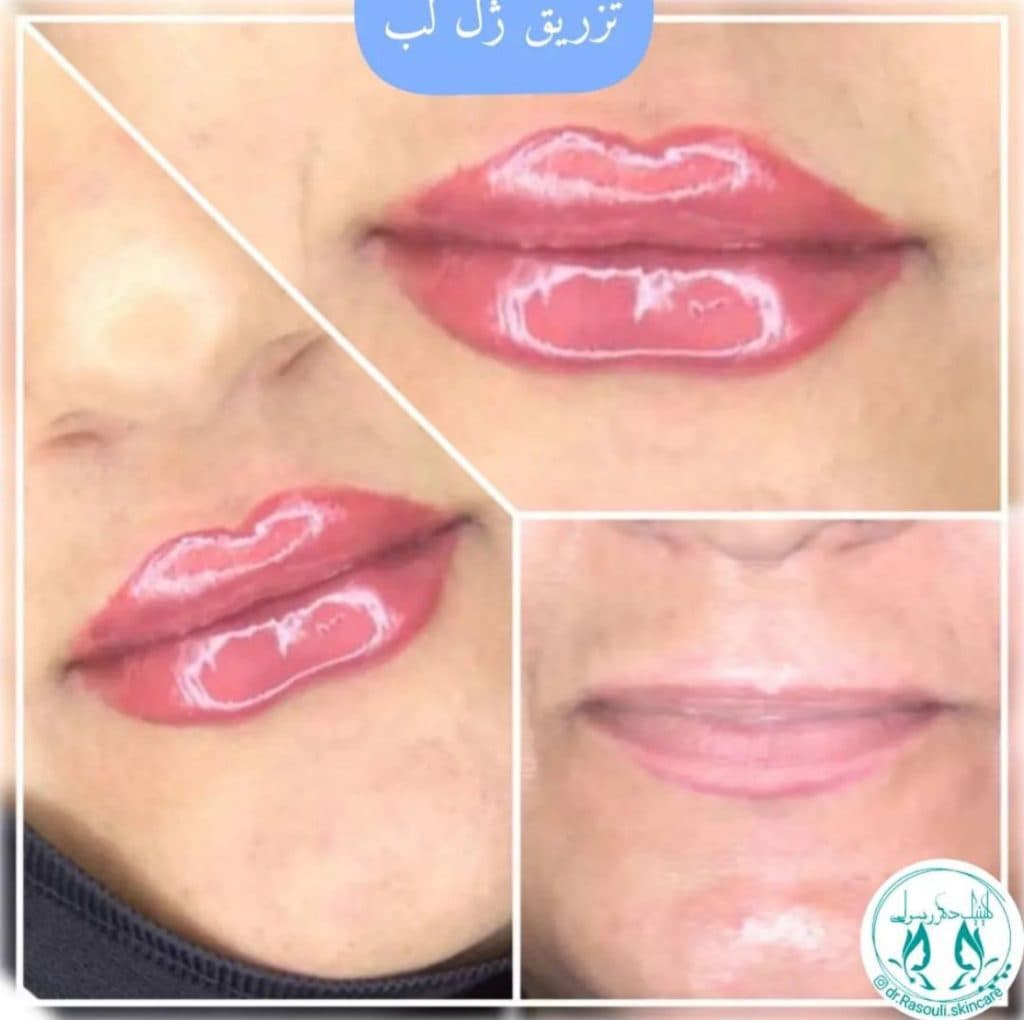کلینیک زیبایی دکتر رسولی در آستانه اشرفیه