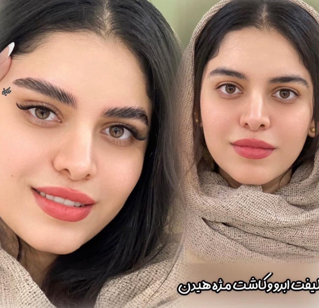 مرکز تخصصی لیفت ابرو و مژه سمانه کیانی در بندرعباس