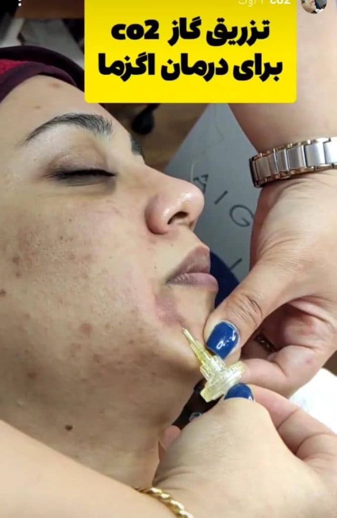 کلینیک پوست مو و زیبایی و لیزر نگارین در گوهردشت کرج