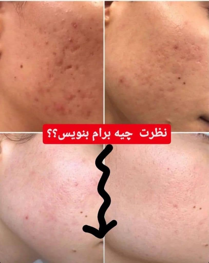 کلینیک پوست مو و زیبایی و لیزر نگارین در گوهردشت کرج