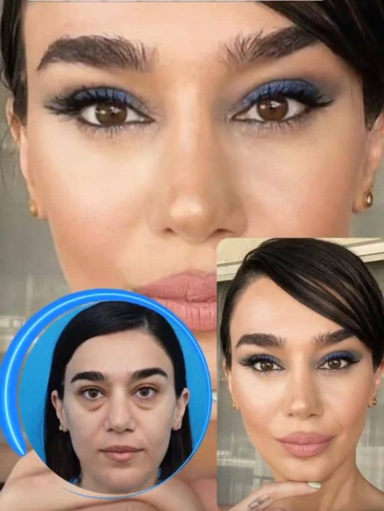 کلینیک زیبایی دکتر بیوتی در نازی آباد تهران