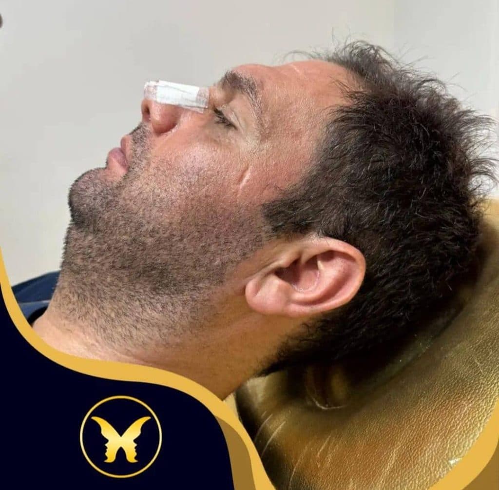 کلینیک زیبایی دکتر بیوتی در نازی آباد تهران