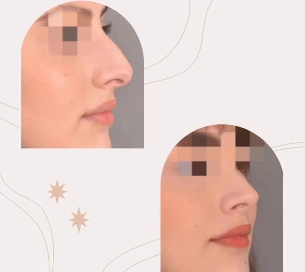 کلینیک زیبایی دکتر بیوتی در نازی آباد تهران