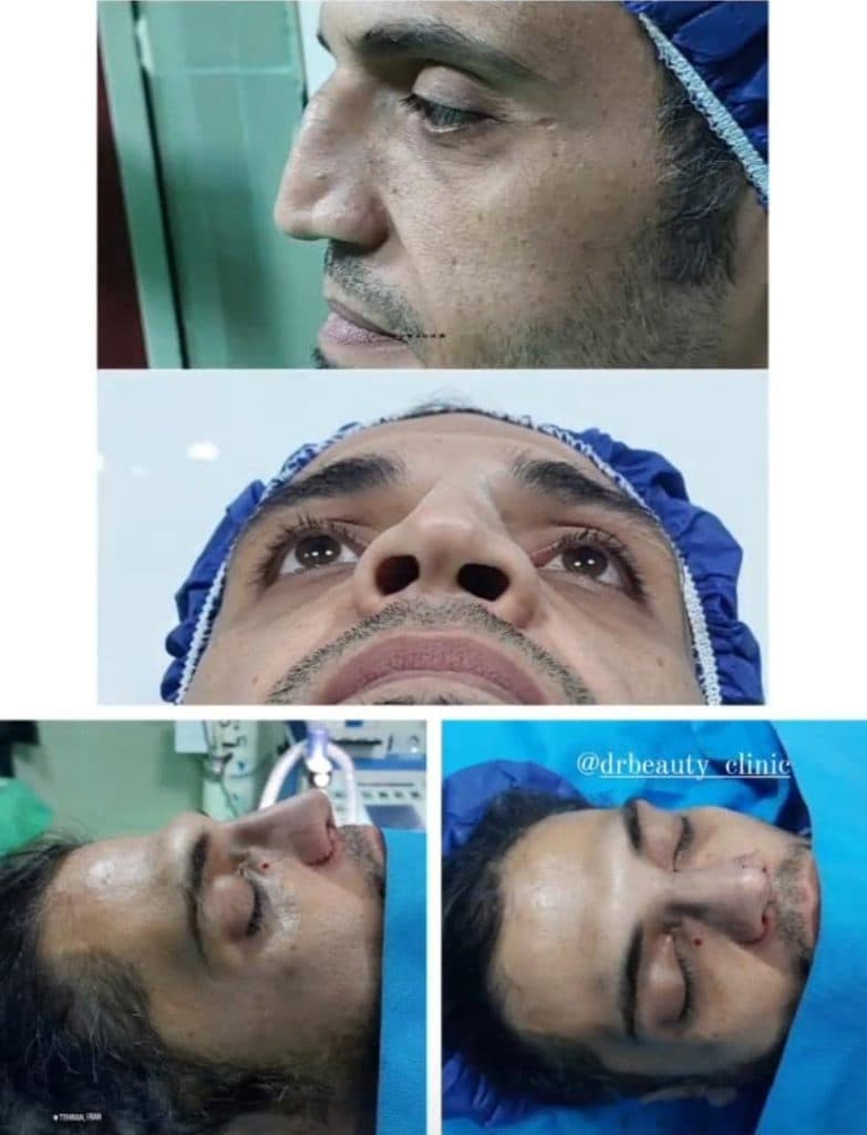 کلینیک زیبایی دکتر بیوتی در نازی آباد تهران