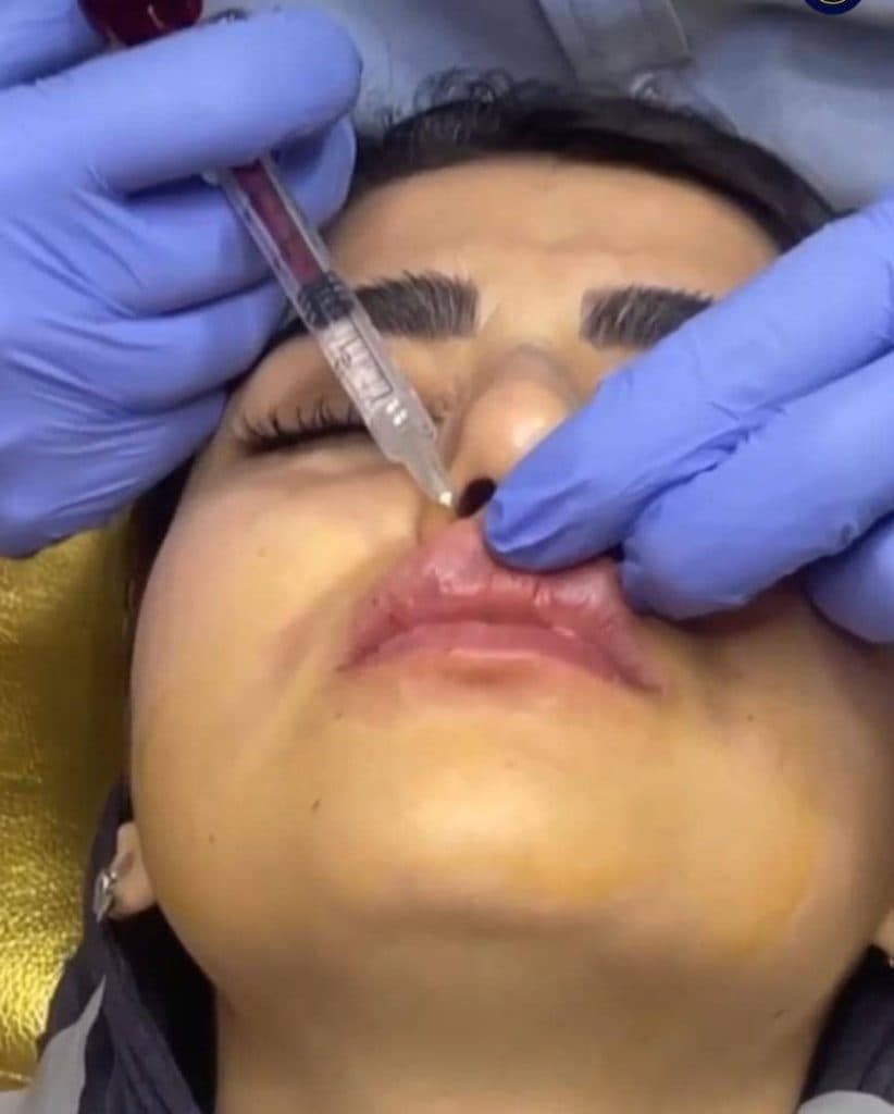 کلینیک زیبایی دکتر بیوتی در نازی آباد تهران