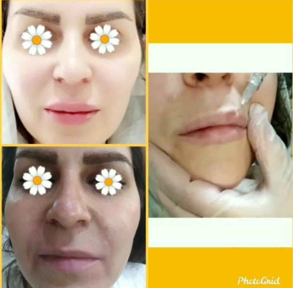 کلینیک لاغری پوست لیزر و زیبایی دکتر نیلوفر حسینی در گوهردشت کرج