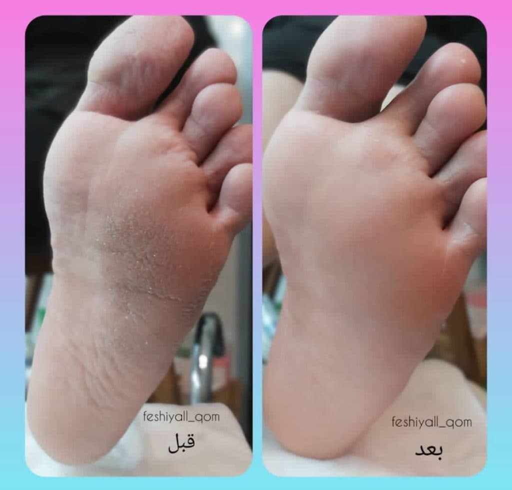 مرکز تخصصی پاکسازی پوست فاطمه کرمانی در قم