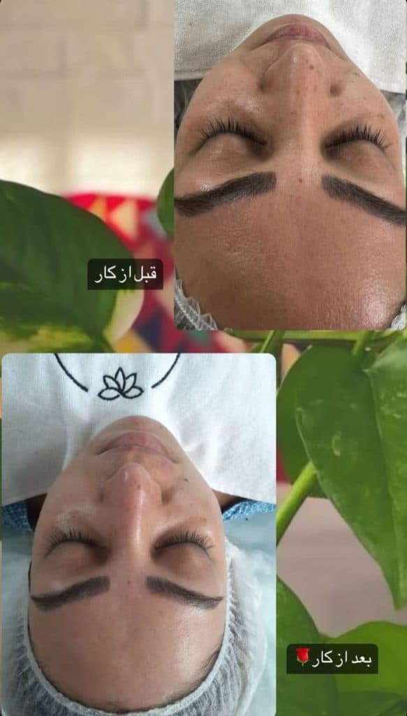 مرکز تخصصی پاکسازی پوست فاطمه کرمانی در قم