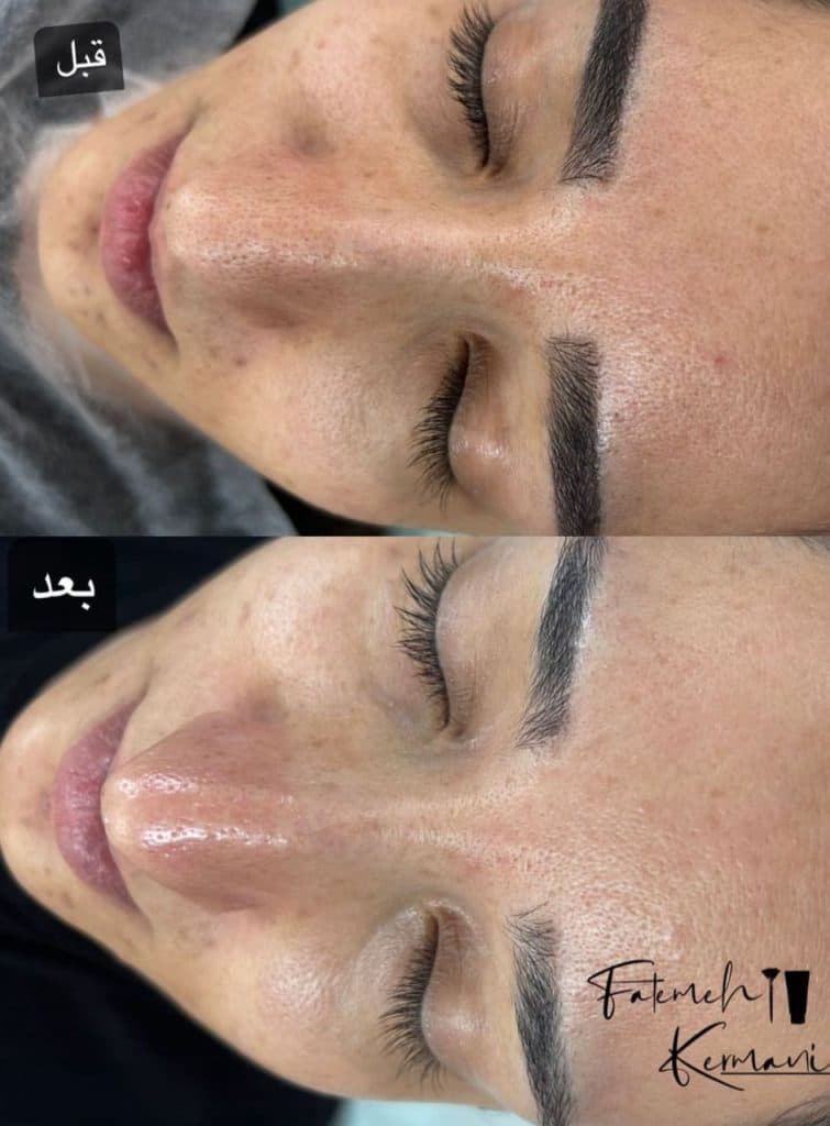 مرکز تخصصی پاکسازی پوست فاطمه کرمانی در قم