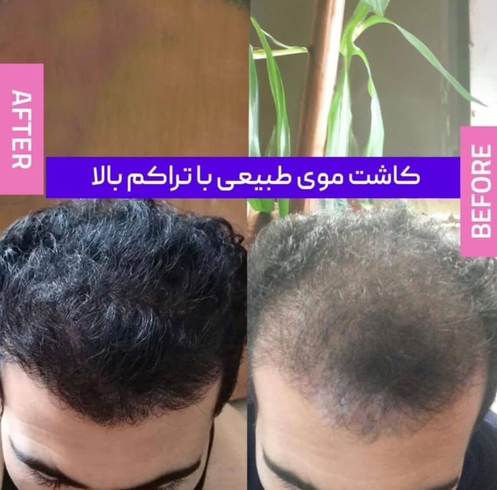 کلینیک زیبایی ژینو در شیراز