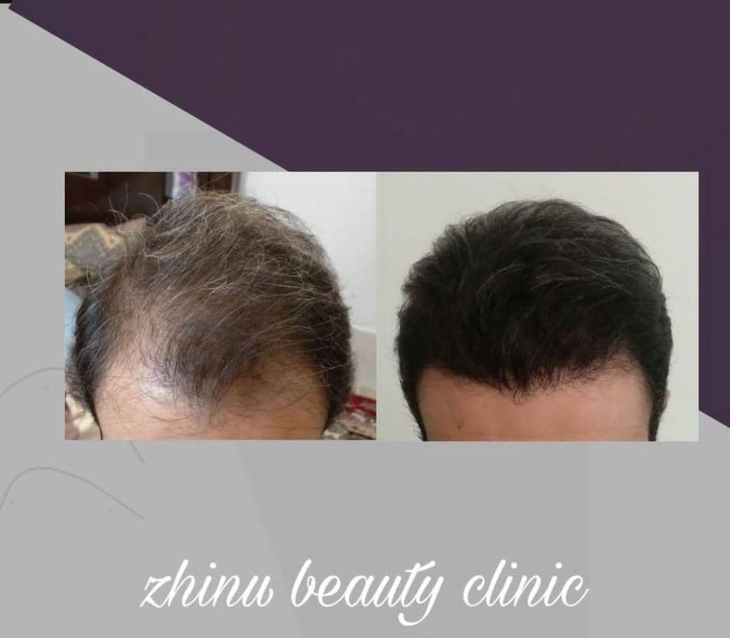 کلینیک زیبایی ژینو در شیراز