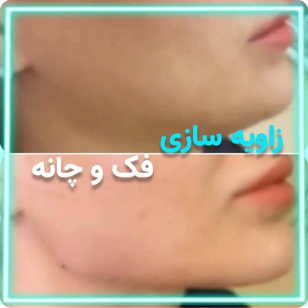 کلینیک تخصصی زیبایی پوست و مو روژمان سلامت موحد در کرمانشاه