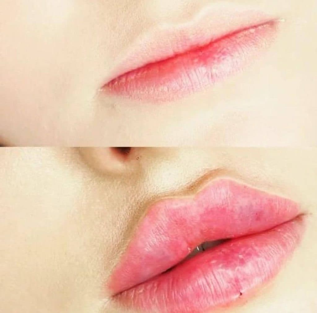 کلینیک تخصصی زیبایی پوست و مو شبنم علیپور در ارومیه