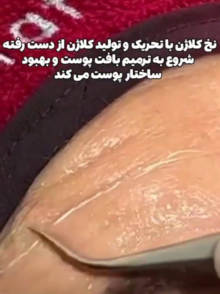 کلینیک پوست مو و زیبایی و لیزر نگارین در گوهردشت کرج