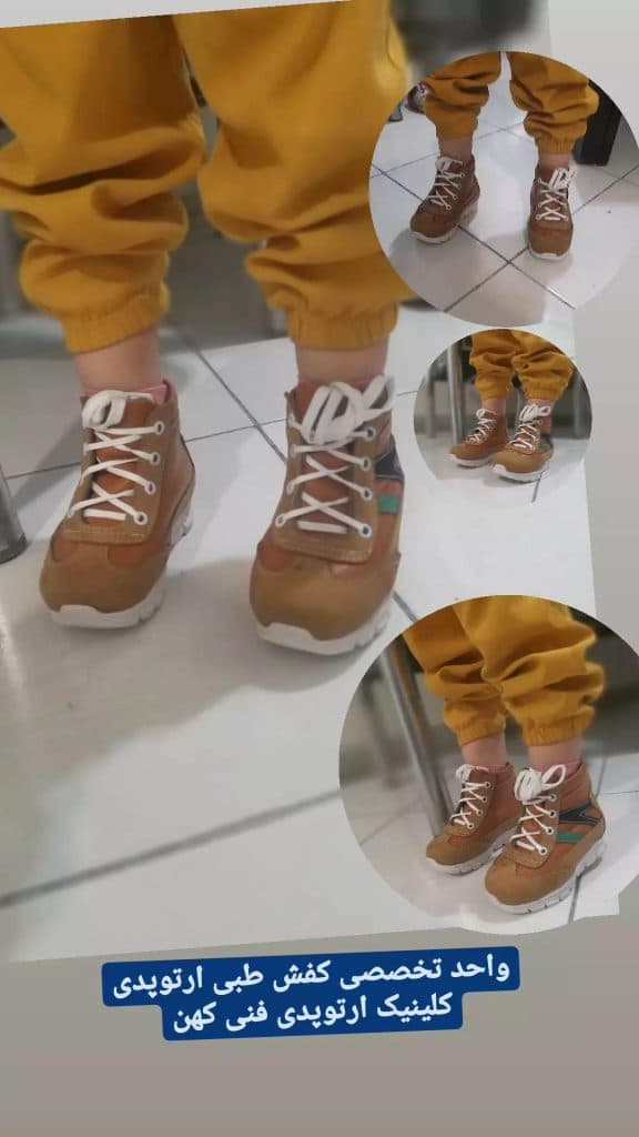 درمان صافی و درد کف پا زانوی پرانتزی قوز کمر کلینیک کهن در تهران