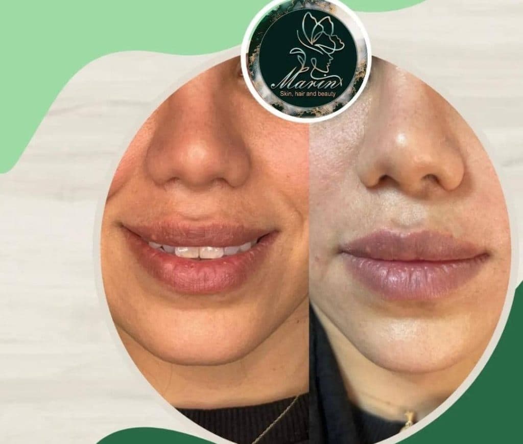 کلینیک زیبایی پوست و مو مارین در کرج