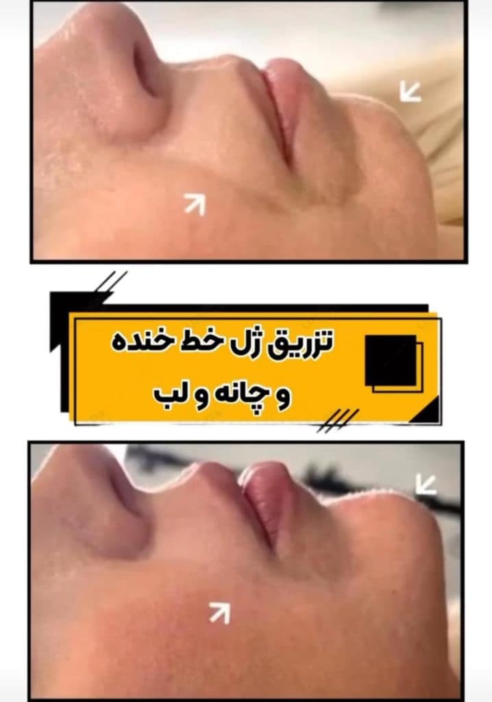 مطب زیبایی پوست و مو دکتر بینا احمدی نژاد در تهران