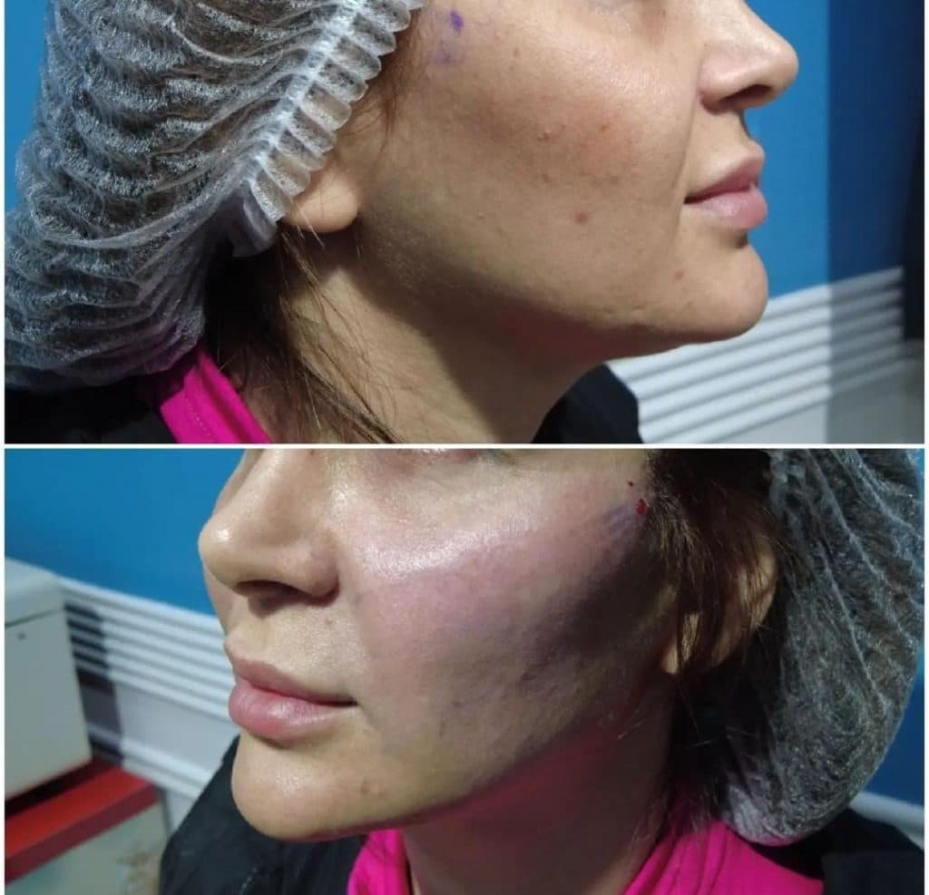 کلینیک زیبایی لیزر هایفوژل و بوتاکس برلیان در معالی آباد شیراز