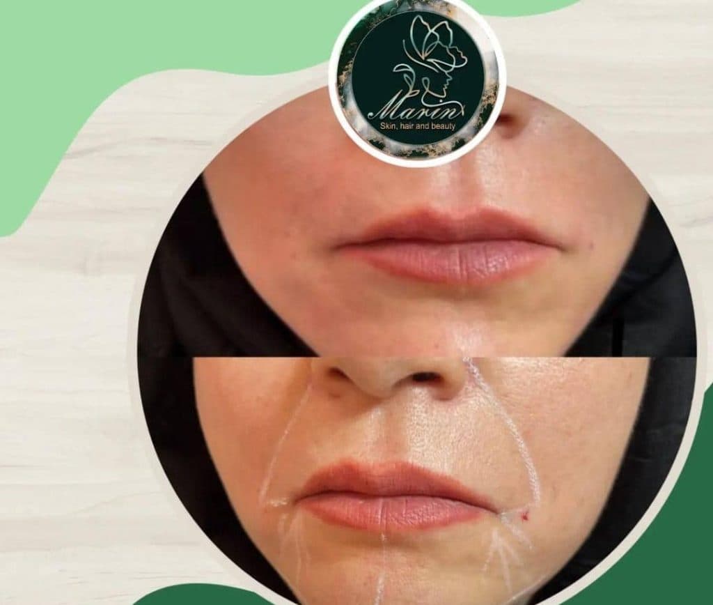 کلینیک زیبایی پوست و مو مارین در کرج