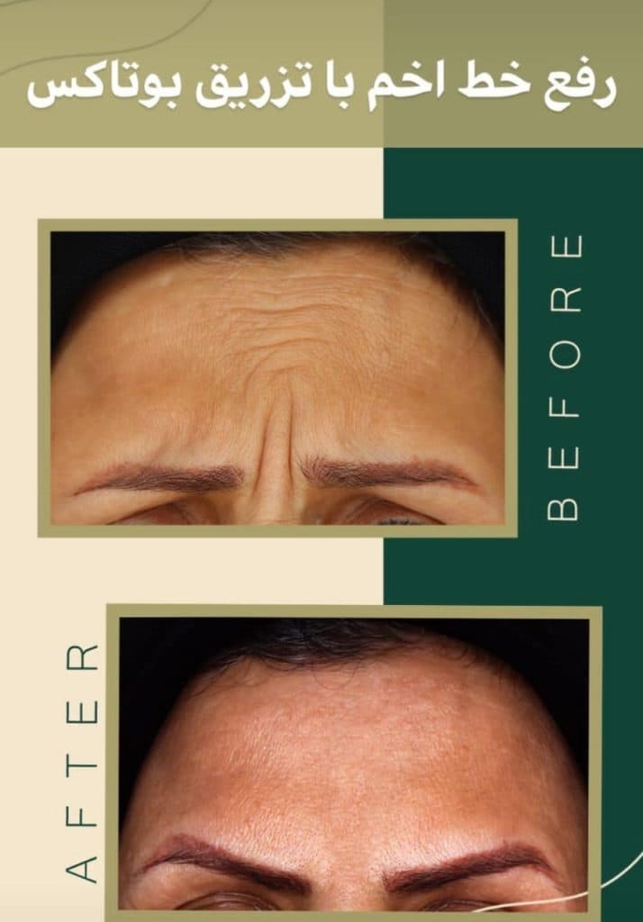 مطب زیبایی پوست و مو دکتر بینا احمدی نژاد در تهران