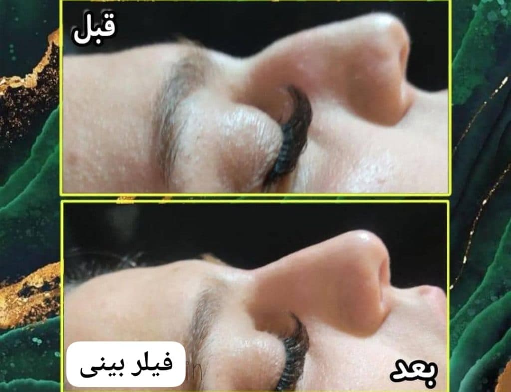 کلینیک زیبایی پوست و مو مارین در کرج