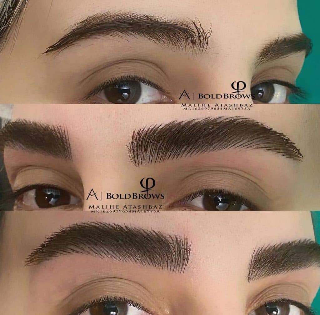 مرکز تخصصی میکروبلیدینگ ابرو و ریموو تتو ملیحه آتشباز در تهرانپارس تهران