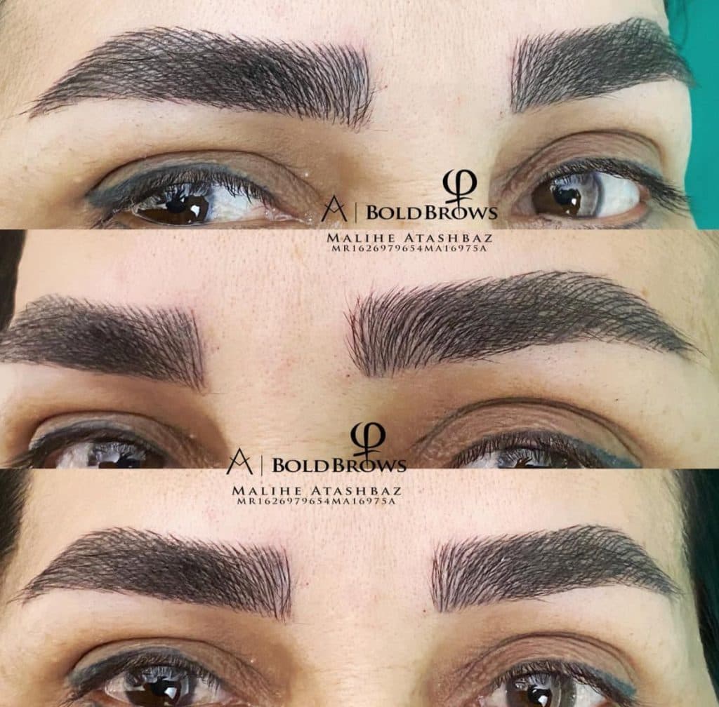 مرکز تخصصی میکروبلیدینگ ابرو و ریموو تتو ملیحه آتشباز در تهرانپارس تهران