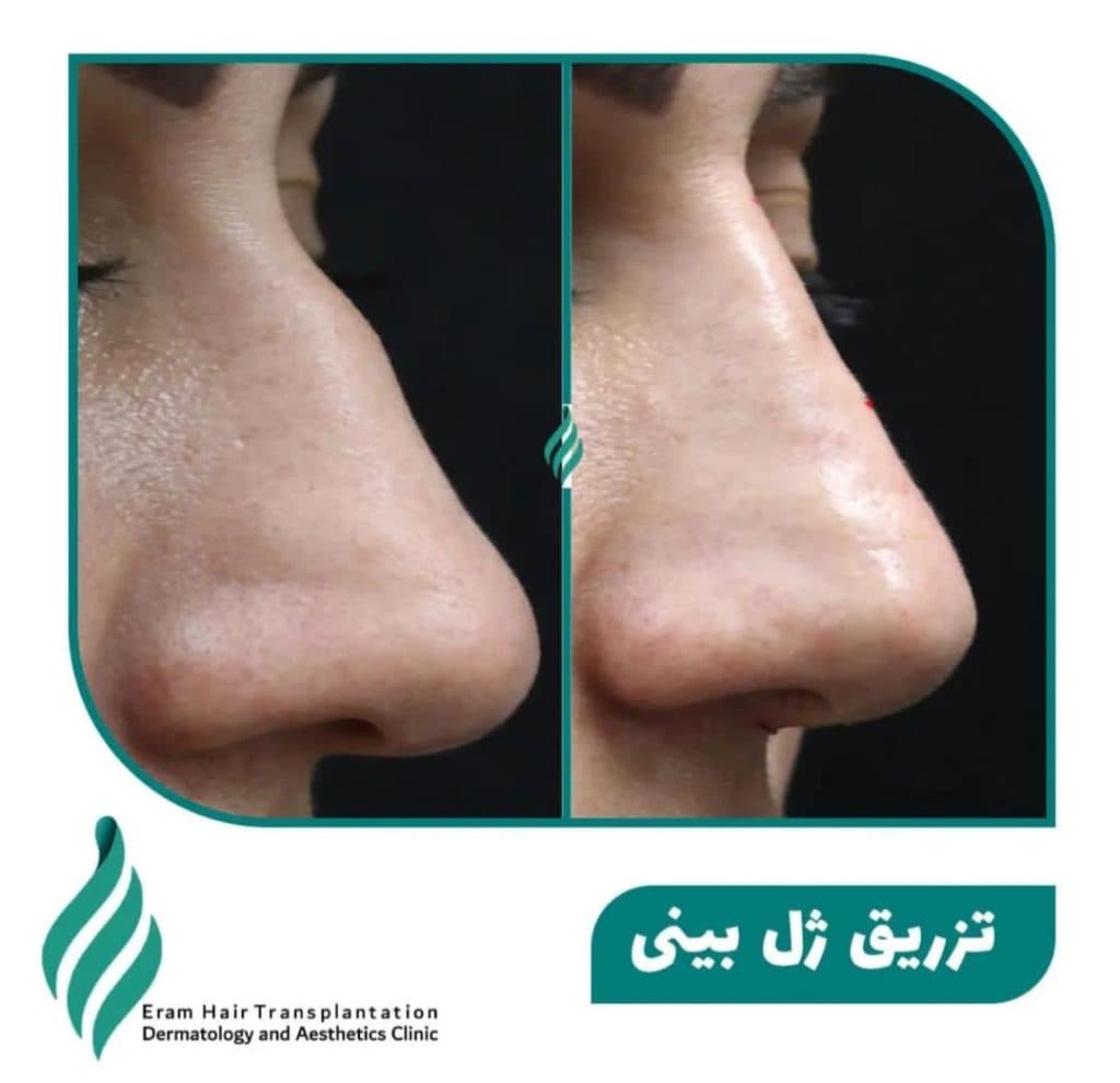 کلینیک تخصصی پوست مو و زیبایی ارم در شیراز